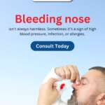 Frequent Nosebleeds Are Not Always Harmless