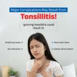 Causes of Tonsillitis