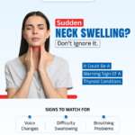 Sudden Swelling In Neck
