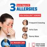 Signs Of Allergies