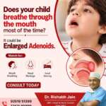 Sign Of Enlarged Adenoids